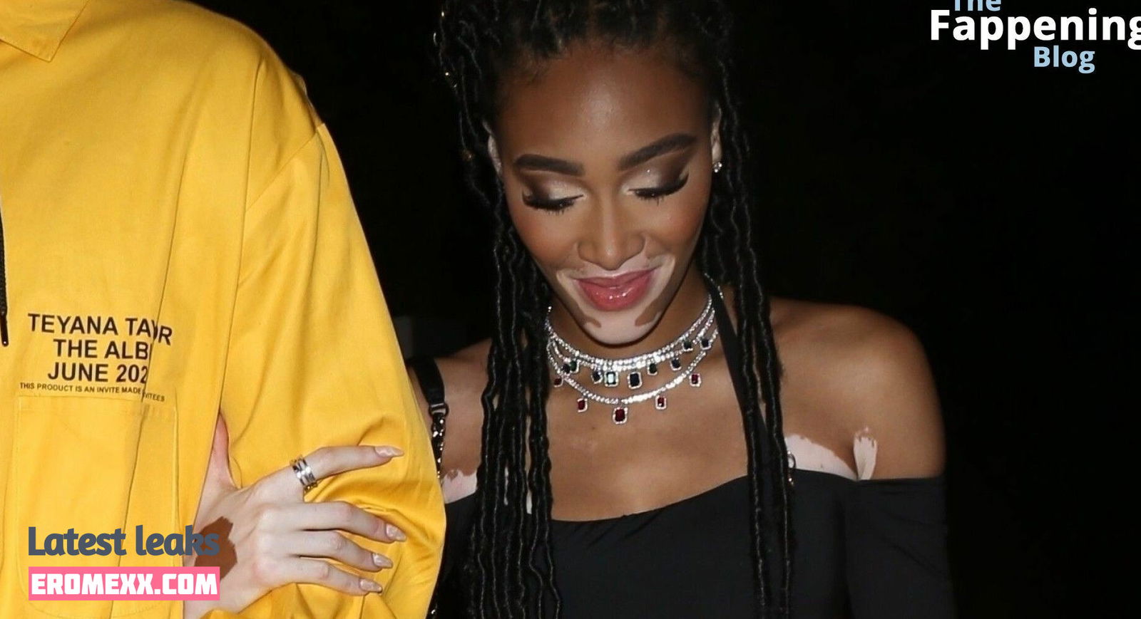 Latest Leaks Winnie Harlow Nude #871 - Fapello