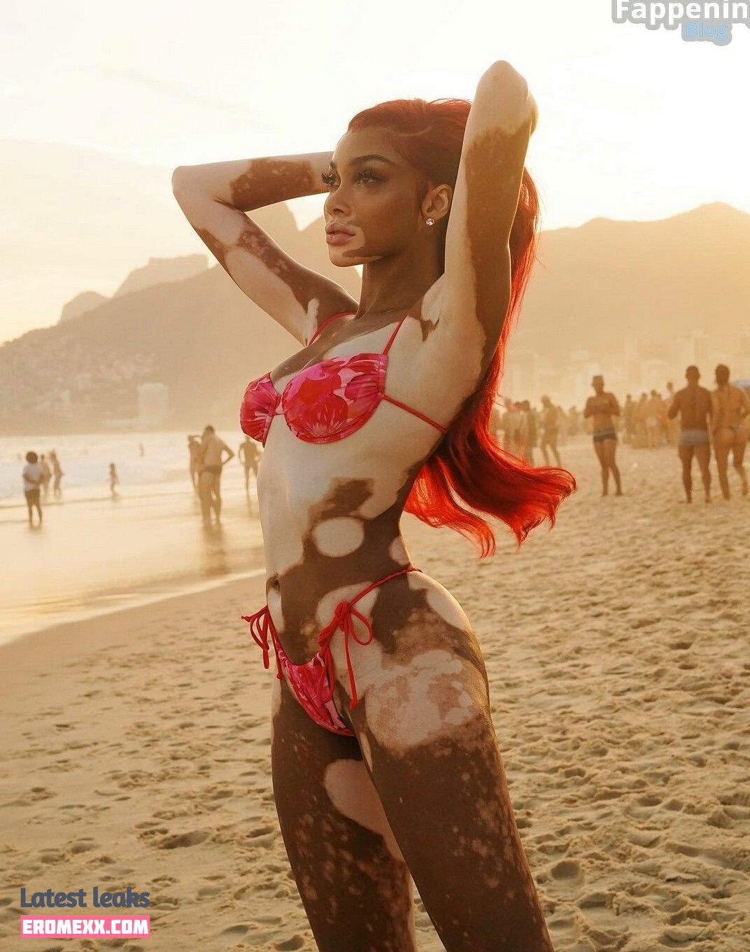Latest Leaks Winnie Harlow Nude #882 - Fapello