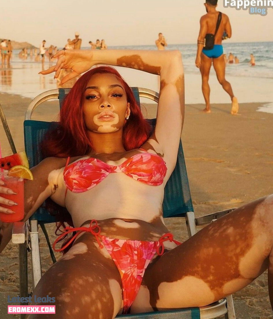 Latest Leaks Winnie Harlow Nude #883 - Fapello