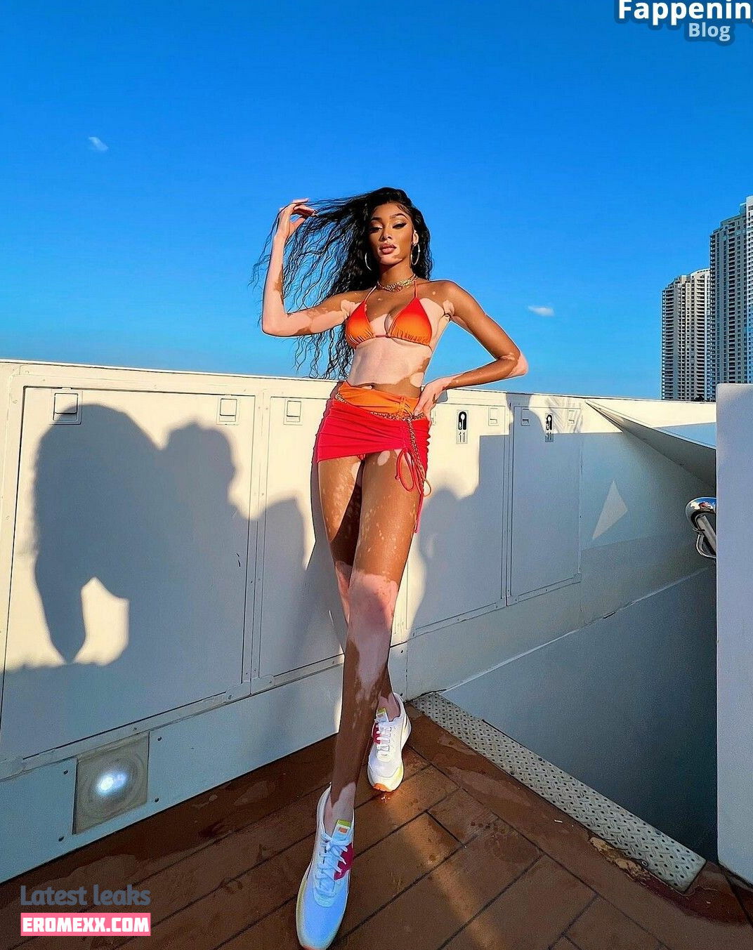 Latest Leaks Winnie Harlow Nude #884 - Fapello