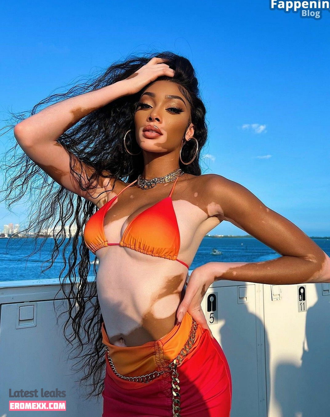 Latest Leaks Winnie Harlow Nude #887 - Fapello