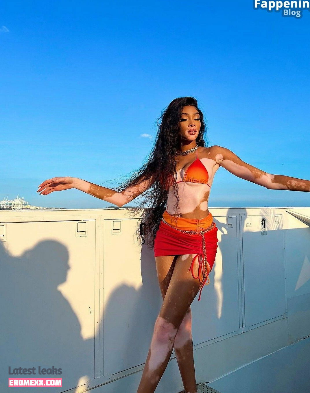 Latest Leaks Winnie Harlow Nude #889 - Fapello