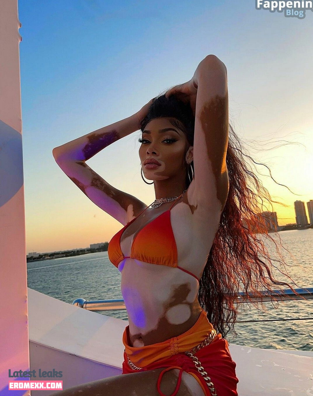 Latest Leaks Winnie Harlow Nude #890 - Fapello