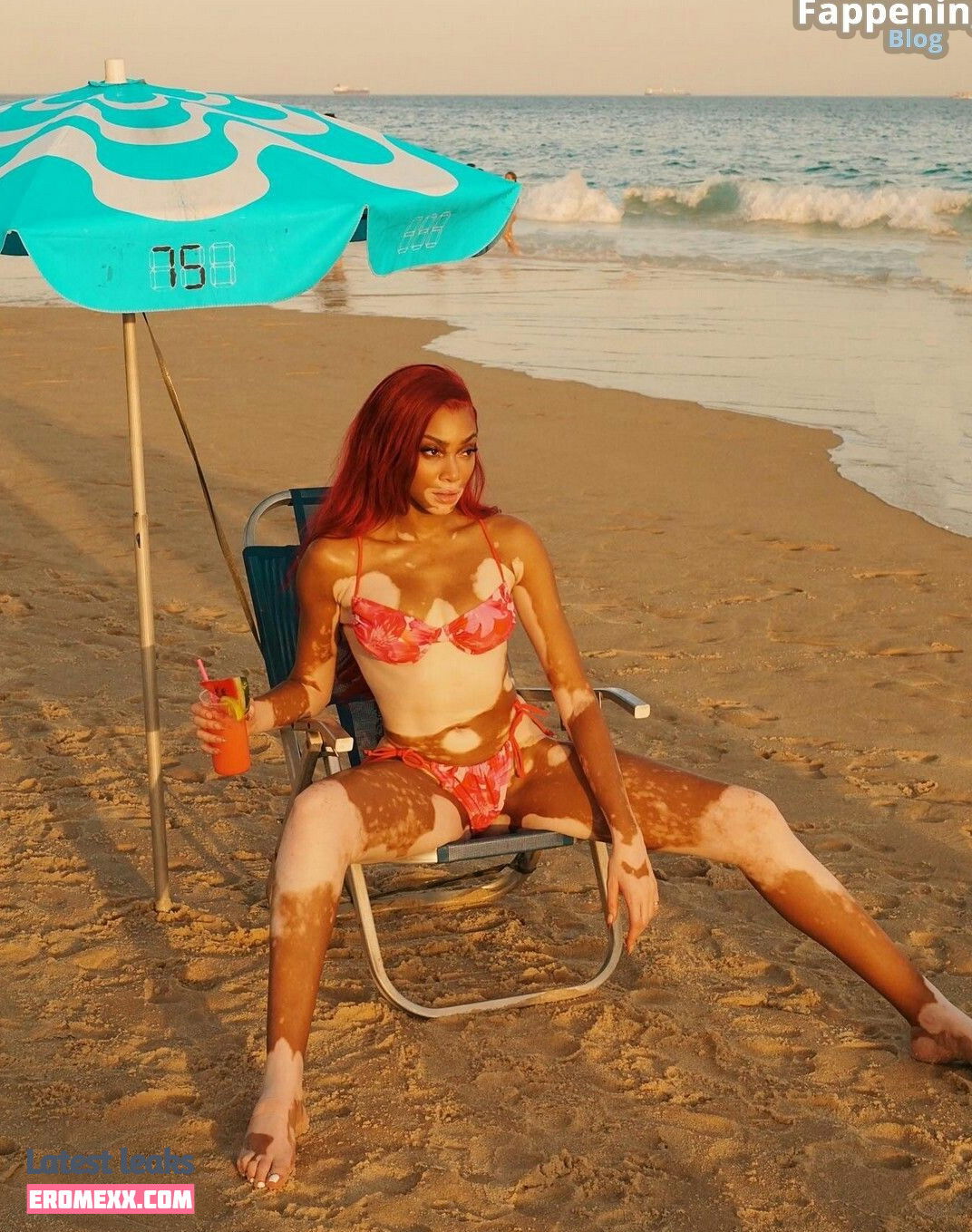 Latest Leaks Winnie Harlow Nude #896 - Fapello