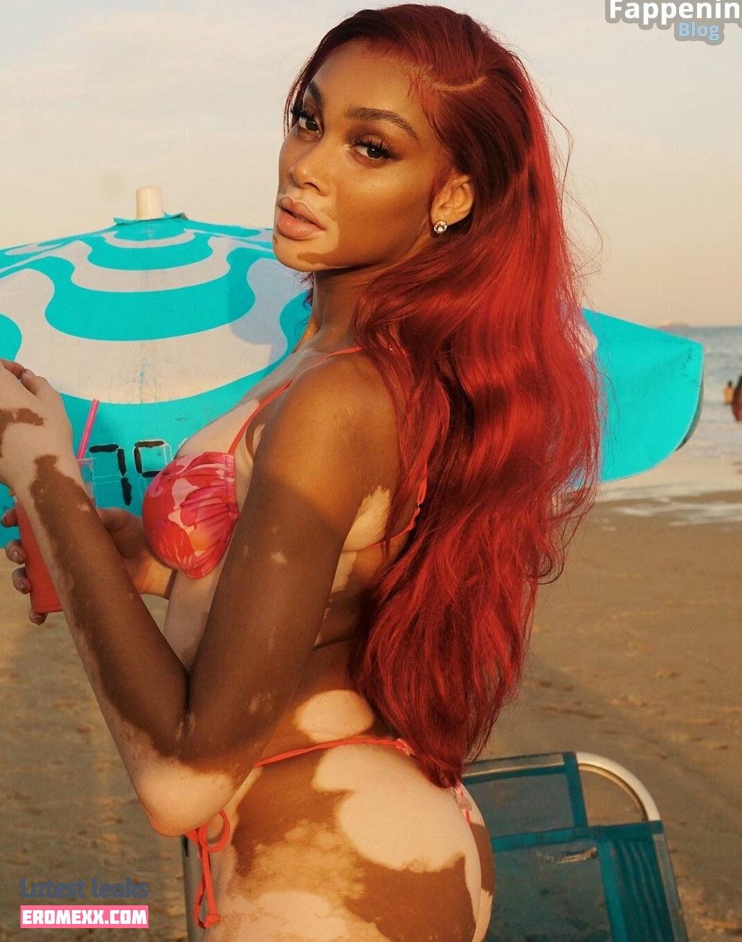 Latest Leaks Winnie Harlow Nude #897 - Fapello