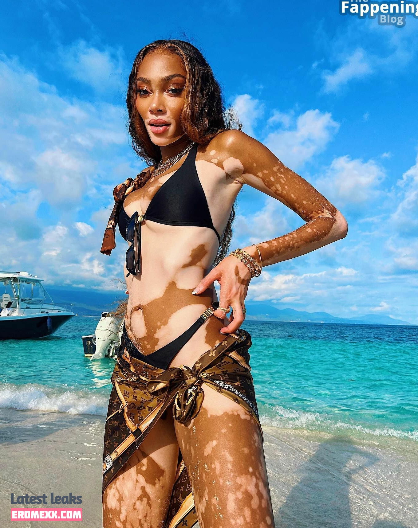 Latest Leaks Winnie Harlow Nude #903 - Fapello