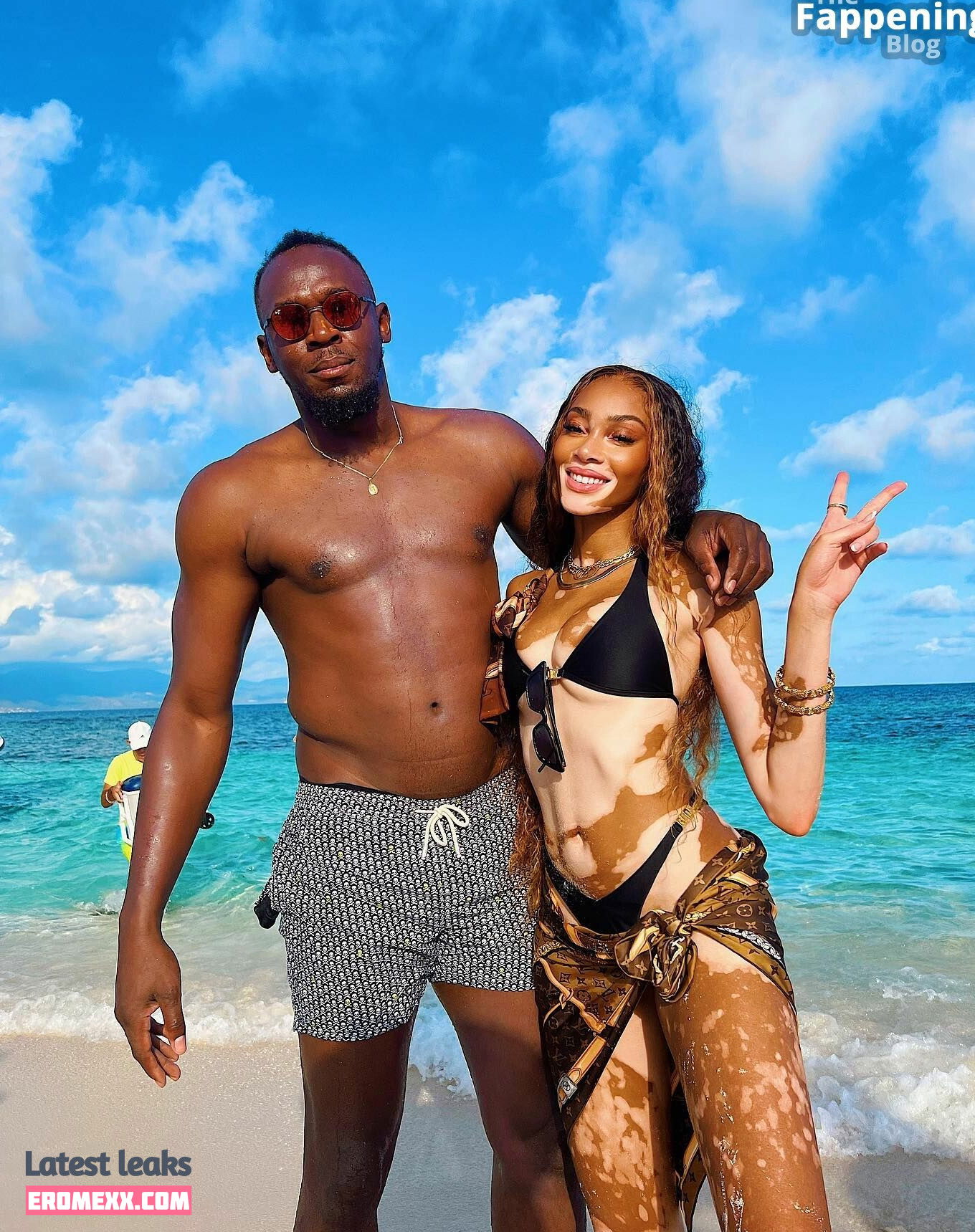 Latest Leaks Winnie Harlow Nude #907 - Fapello