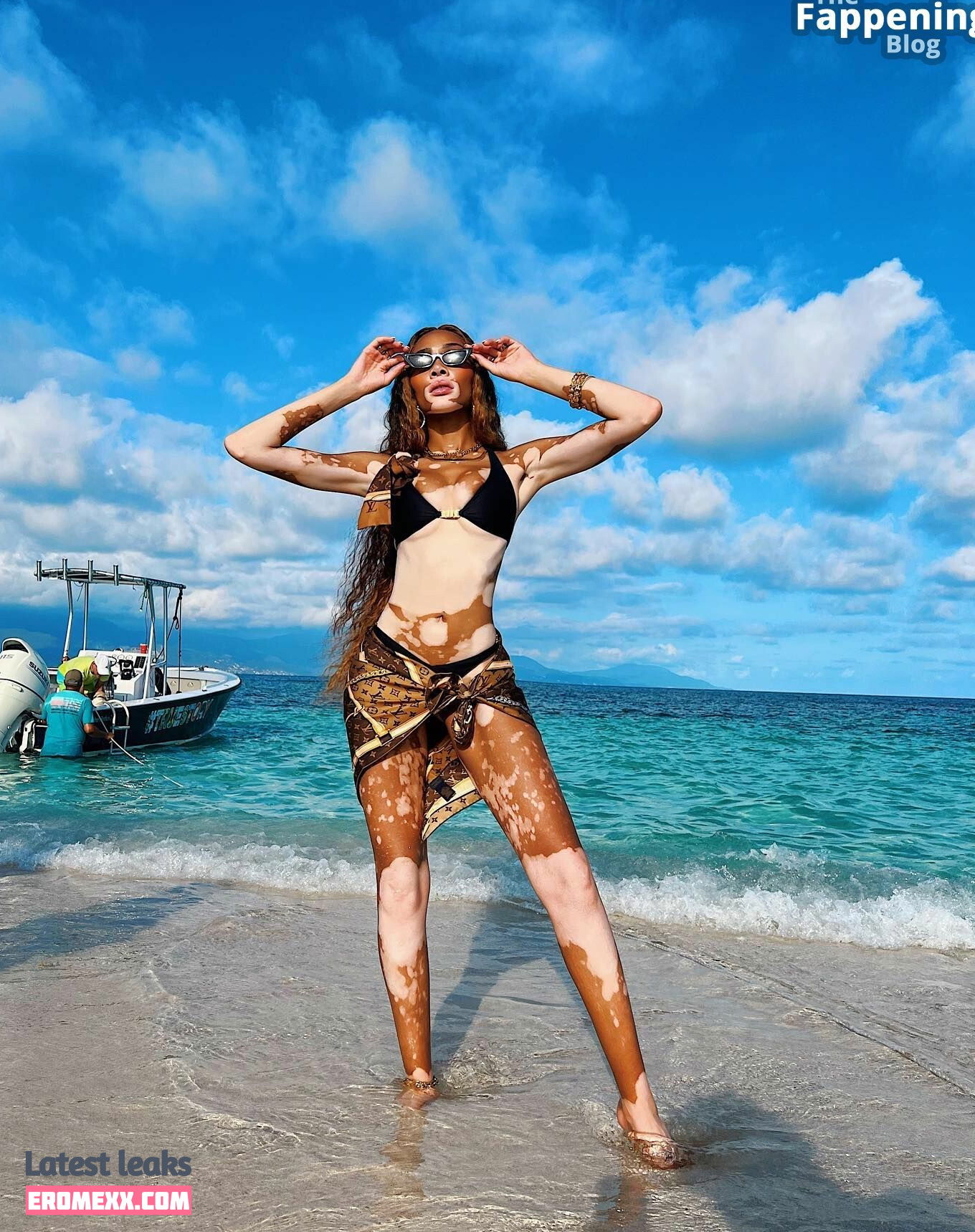 Latest Leaks Winnie Harlow Nude #908 - Fapello
