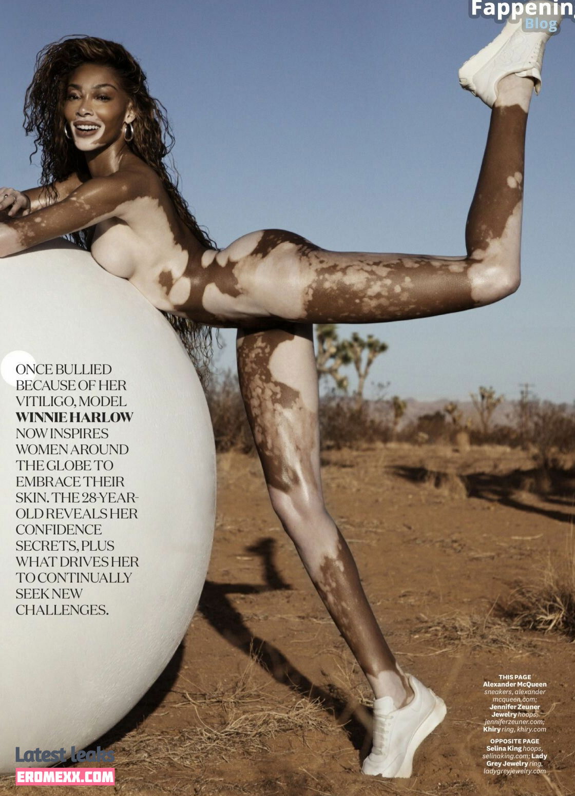 Latest Leaks Winnie Harlow Nude #914 - Fapello