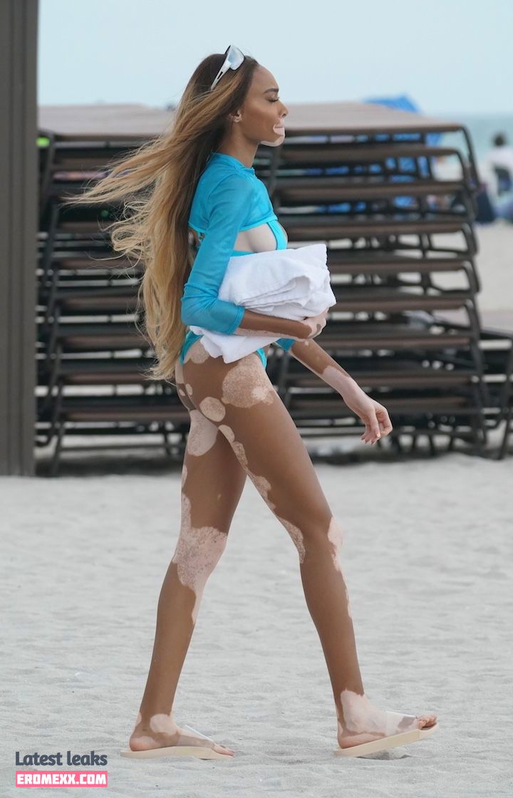 Latest Leaks Winnie Harlow Nude #92 - Fapello