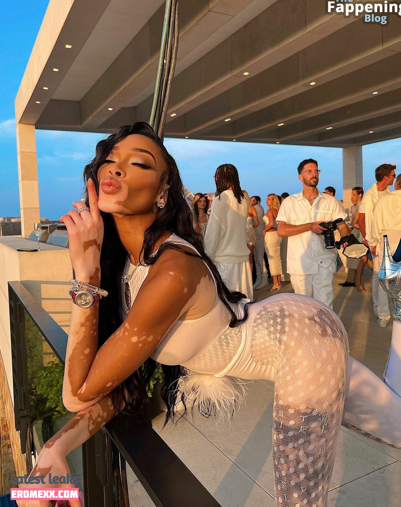 Latest Leaks Winnie Harlow Nude #927 - Fapello