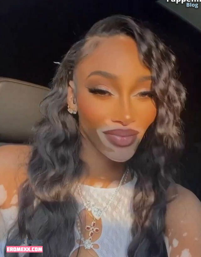 Latest Leaks Winnie Harlow Nude #928 - Fapello