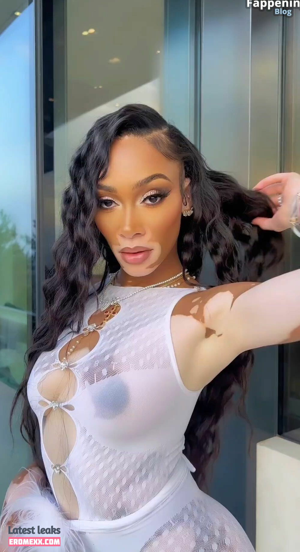 Latest Leaks Winnie Harlow Nude #933 - Fapello