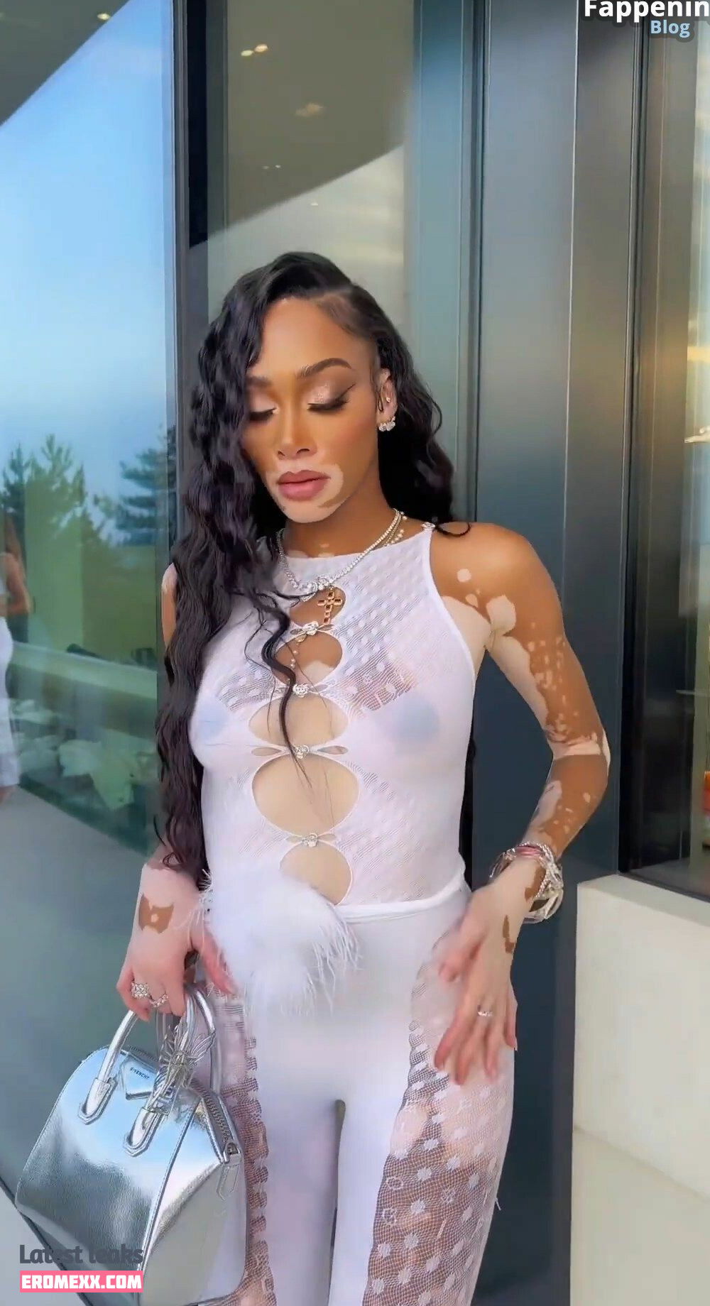 Latest Leaks Winnie Harlow Nude #934 - Fapello