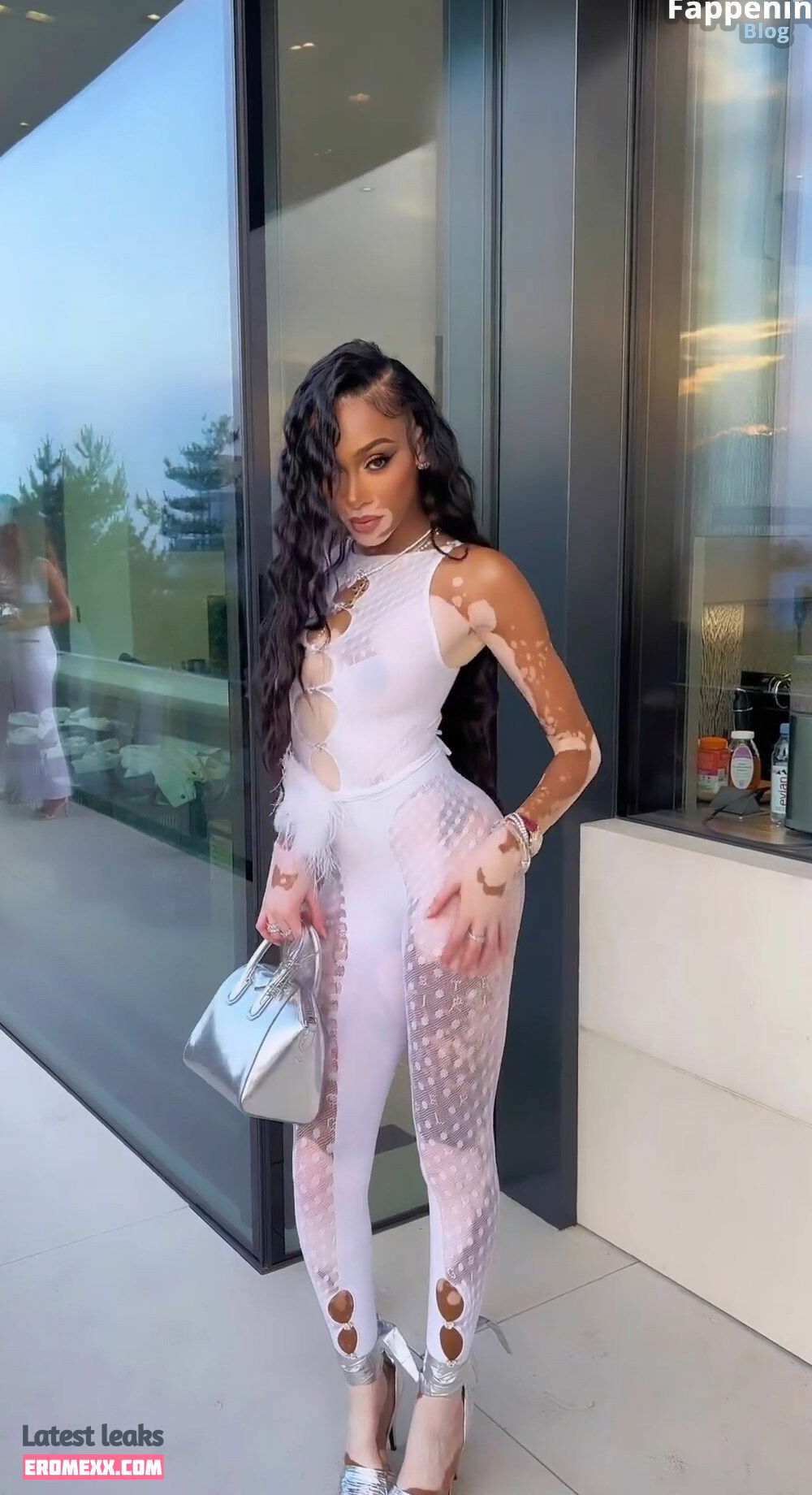 Latest Leaks Winnie Harlow Nude #935 - Fapello