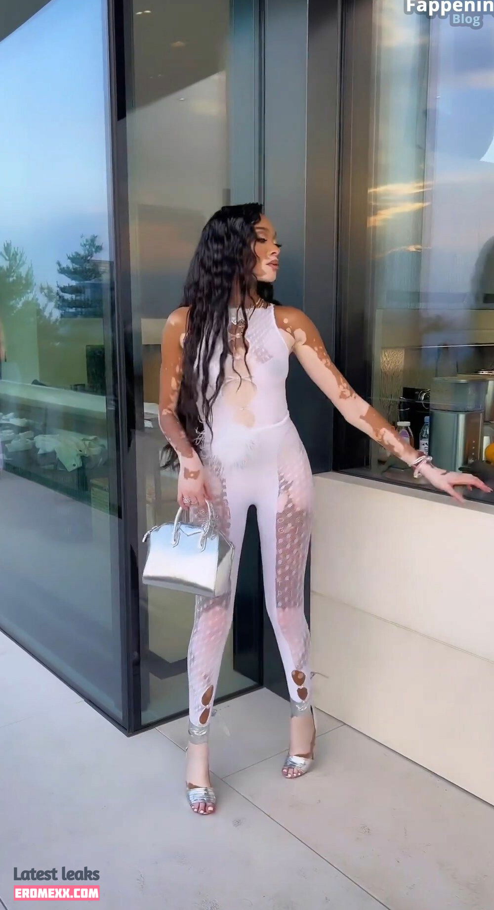 Latest Leaks Winnie Harlow Nude #936 - Fapello