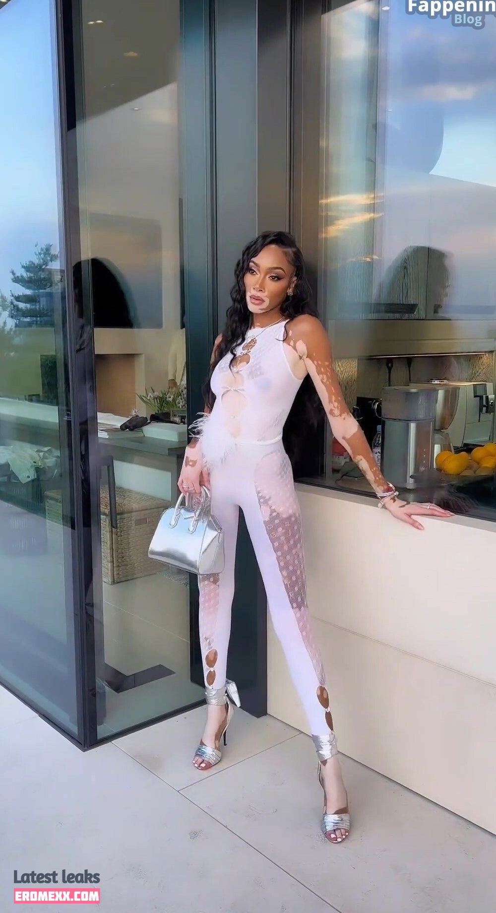 Latest Leaks Winnie Harlow Nude #937 - Fapello