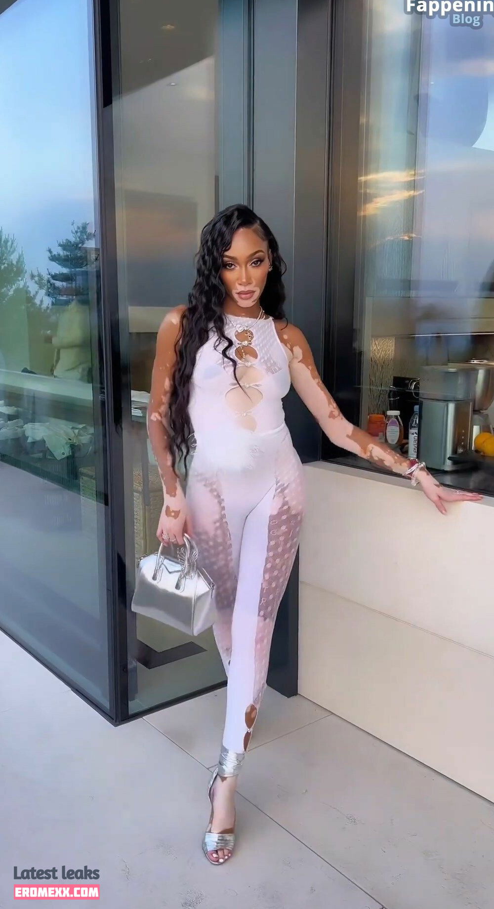 Latest Leaks Winnie Harlow Nude #938 - Fapello