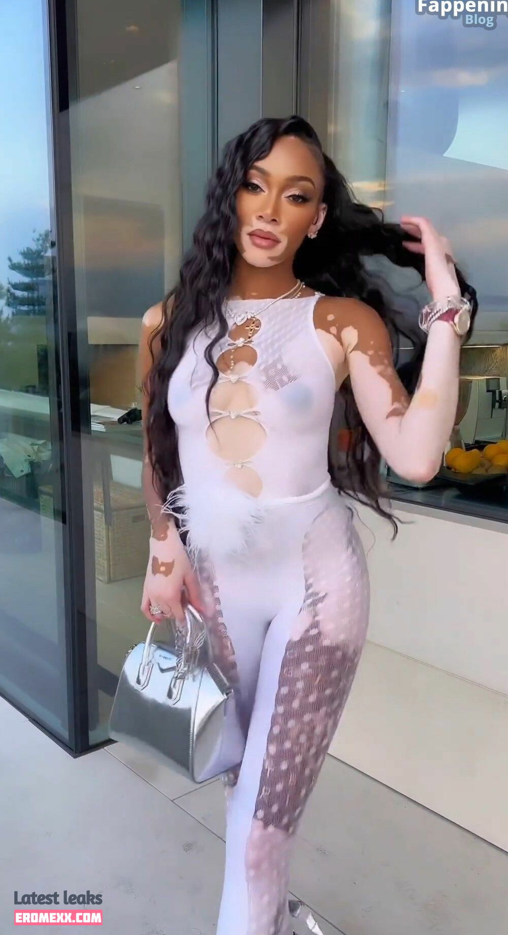 Latest Leaks Winnie Harlow Nude #939 - Fapello