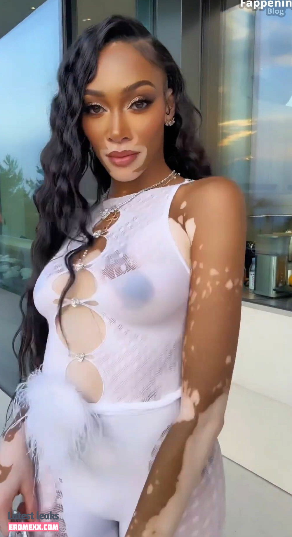 Latest Leaks Winnie Harlow Nude #940 - Fapello