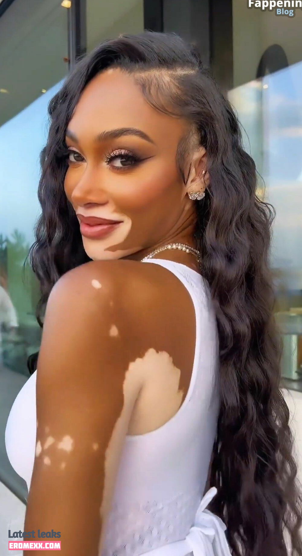 Latest Leaks Winnie Harlow Nude #941 - Fapello