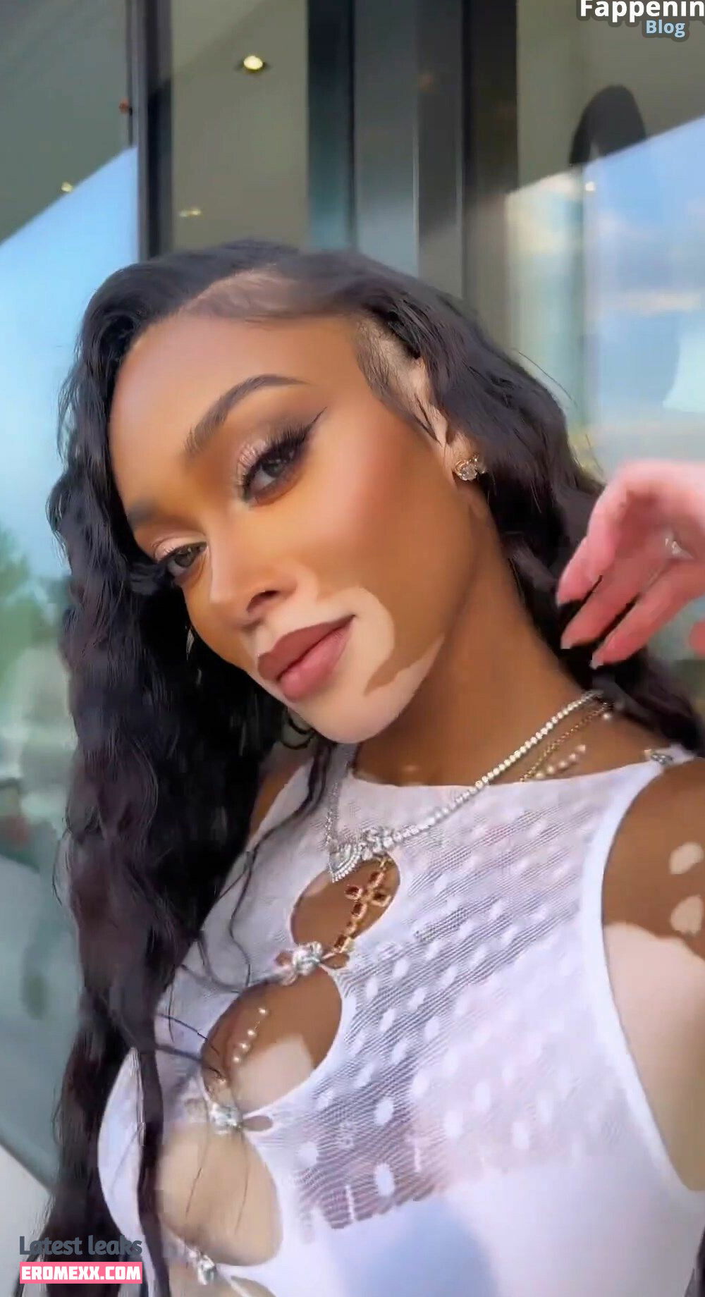 Latest Leaks Winnie Harlow Nude #942 - Fapello