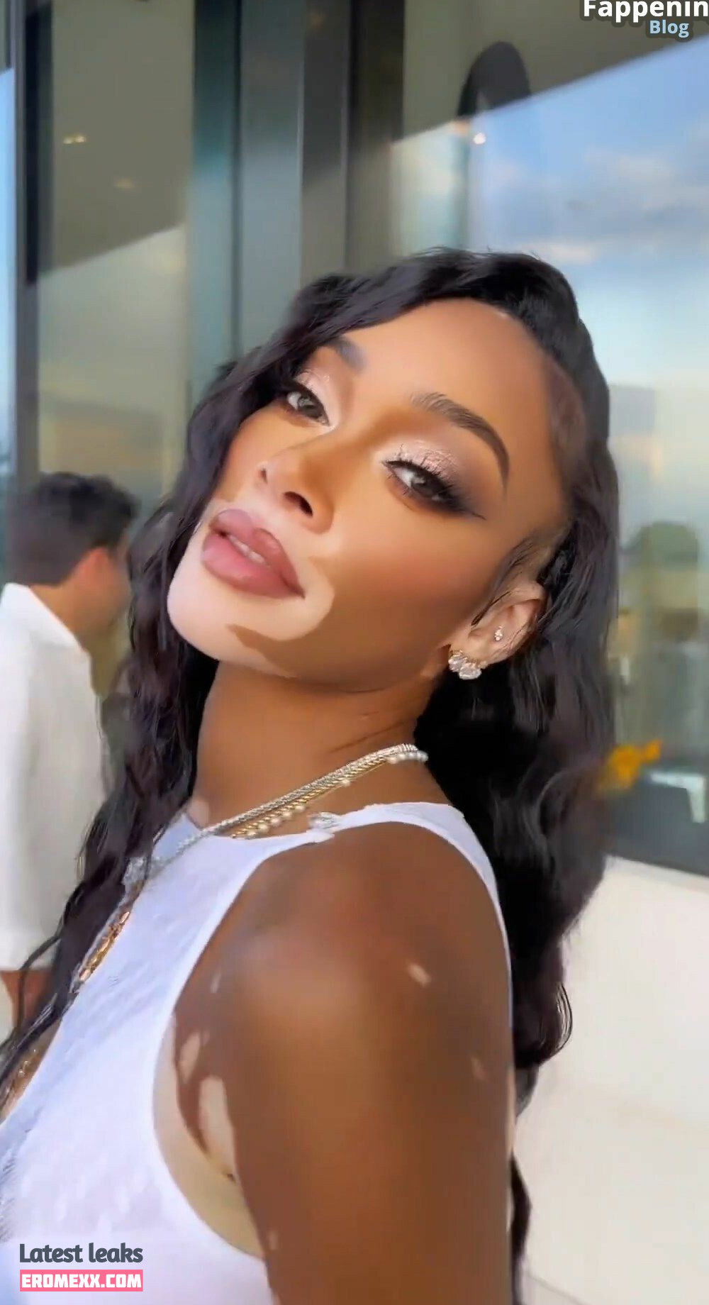 Latest Leaks Winnie Harlow Nude #943 - Fapello