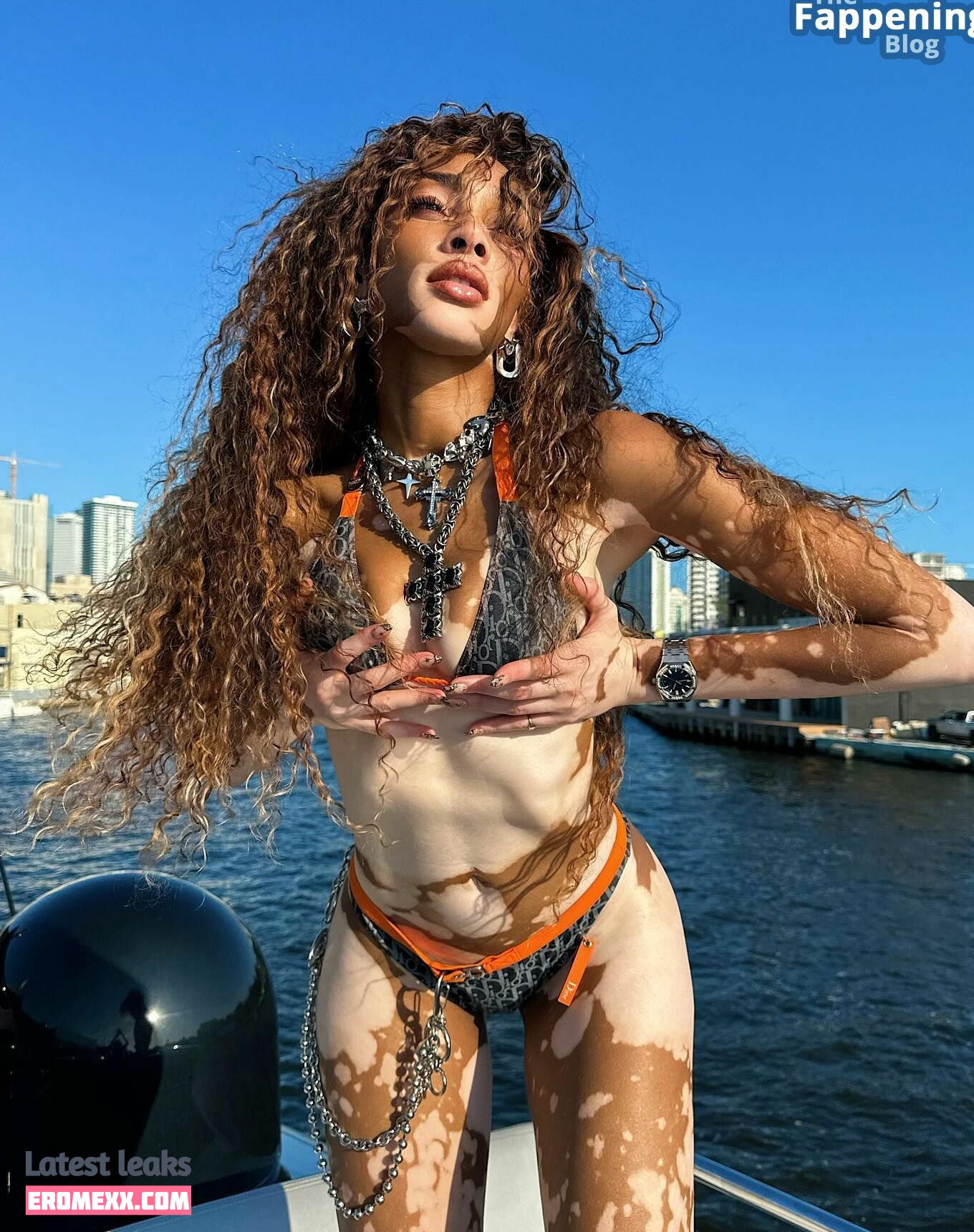 Latest Leaks Winnie Harlow Nude #998 - Fapello
